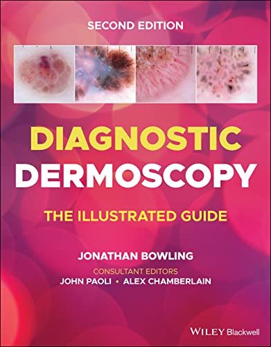 Diagnostic Dermoscopy: The Illustrated Guide