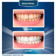 BetterWhite Professional Teeth Whitening Strips 21 Treatments - Enamel Safe - Non-Sensitive Formula - 42 Peroxide-Free Whitening Strips - Dentist Formulated Teeth Whitening Kit and Mouth Opener Included