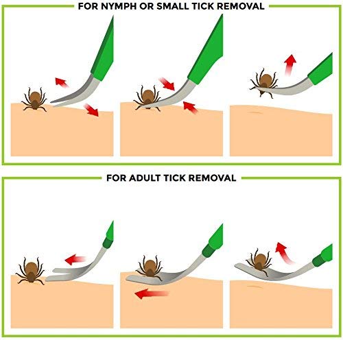 TickCheck Premium Tick Remover Kit (Stainless Steel Tick Remover with Tweezers, Leather Case and Pocket Tick Identification Card)