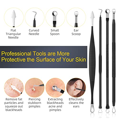 Blackhead Remover Tool Kit, IUMAKEVP 15 PCS Professional Stainless Steel Pimple Popper Comedone Extractor Tools for Removing Pimples, Blackheads, Zit on Face - Acne Removal Kit with Metal Case (Black)