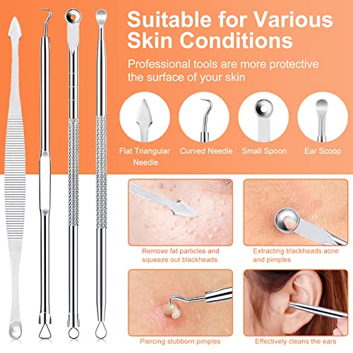 Blackhead Remover Tool Kit, IUMAKEVP 15 PCS Professional Stainless Steel Pimple Popper Comedone Extractor Tools for Removing Pimple, Blackheads, Zit on Face - Acne Removal Kit with Metal Case (Silver)