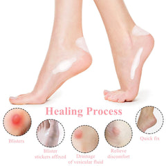 15 Pieces Hydrocolloid Blister Plasters Bandages Invisible Blister Pads Waterproof Blister Cushion for Fingers, Toes, Forefoot, Heel Blister Prevention and Recovery, 5 Sizes