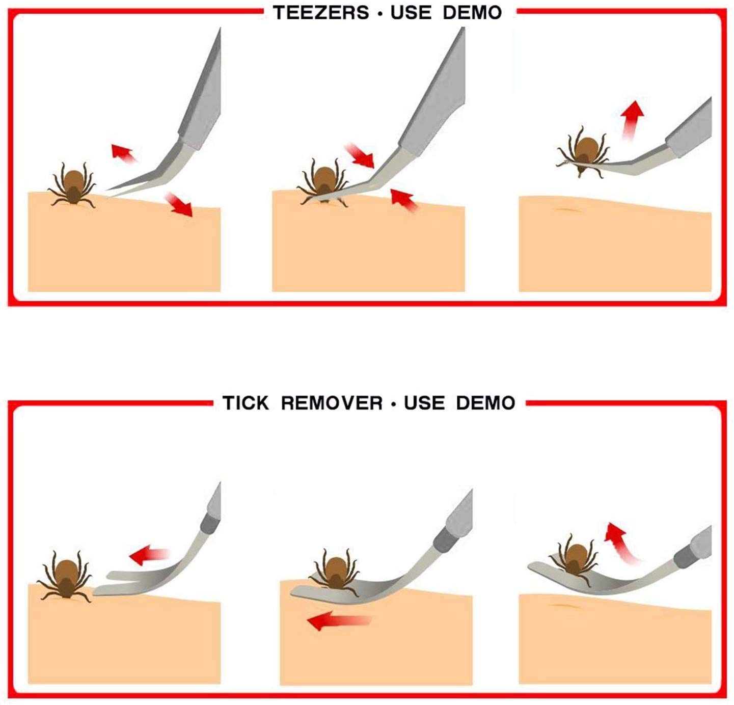 EasyULT Tick Remover, Sided Stainless Steel Tick Remover, with Storage Iron Box Easy Remove, Ticks Tick Remover Tool for Humans, Dogs, Cats