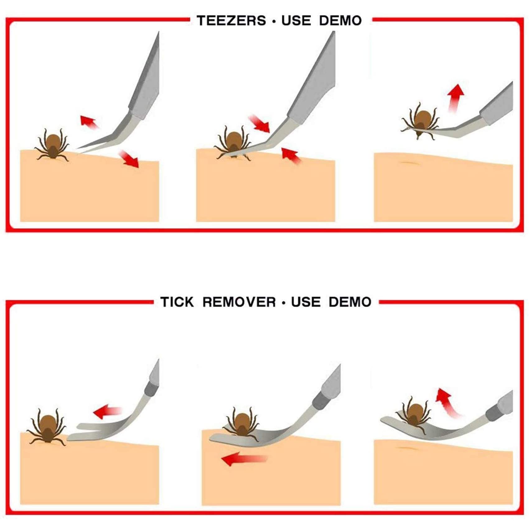 EasyULT 2 in 1 Tick Remover, Stainless Steel Professional Tick Removal Tool, Safe Tick Remover for Pet, Humans, Dogs, Cats