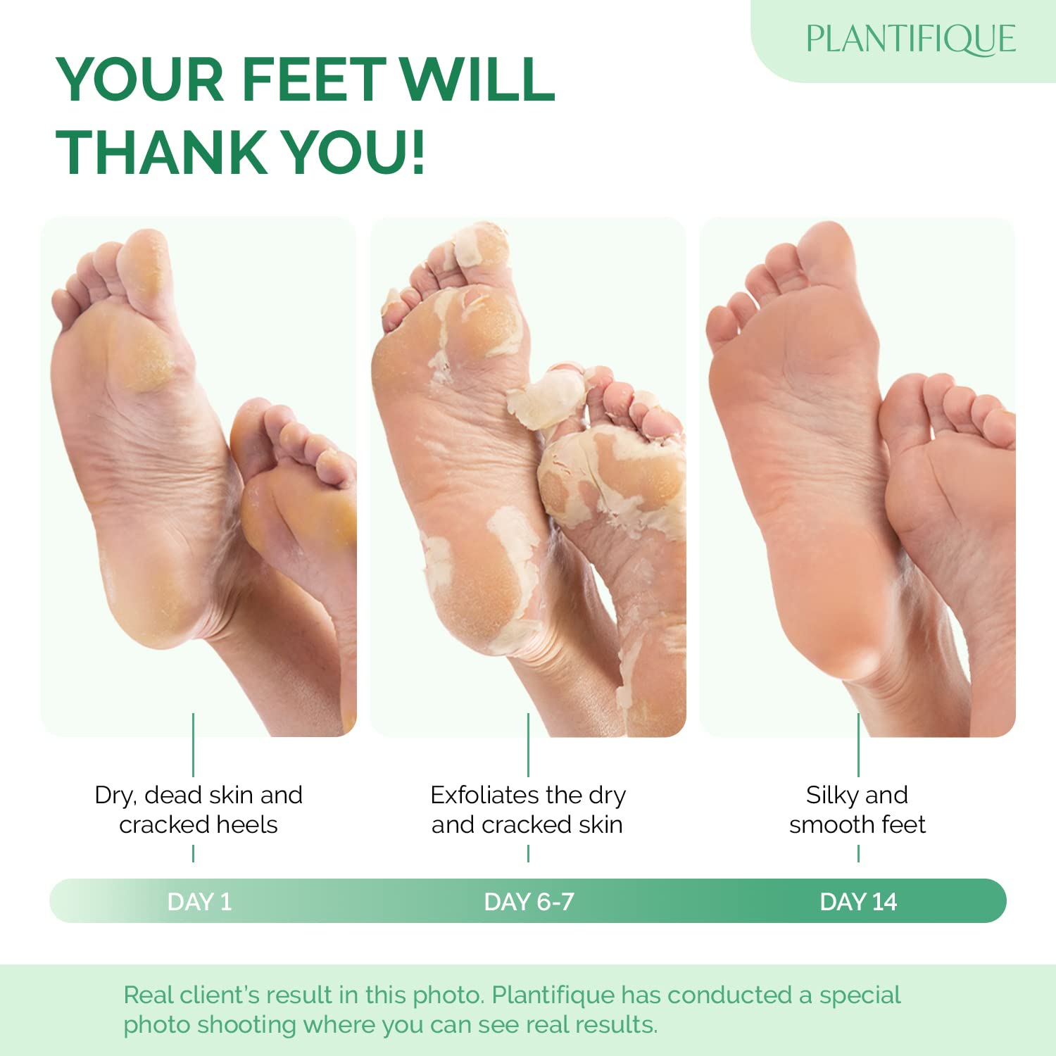 Plantifique Foot Peel Mask - Foot Mask Dermatologically Tested - Repair Heels & Removes Dry Dead Skin for Soft Baby Feet - Exfoliating Peel Mask for Hard Skin - Peeling (Peach 2Pack)