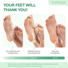 Plantifique Foot Peel Mask - Foot Mask Dermatologically Tested - Repair Heels & Removes Dry Dead Skin for Soft Baby Feet - Exfoliating Peel Mask for Hard Skin - Peeling (Peach 2Pack)