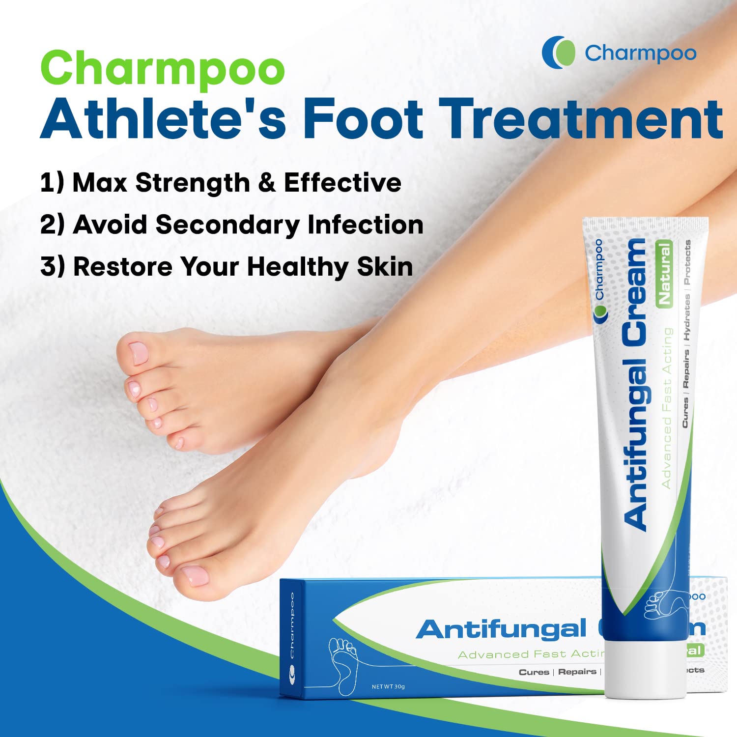 Athletes Foot Treatment, Antifungal Cream, Anti Fungus Skin Cream Extra Strength, Athletes Foot Cream for Men, Ringworm Antifungal Cream, Fast Relief for Jock Inch & Fungal Infections（1pack）