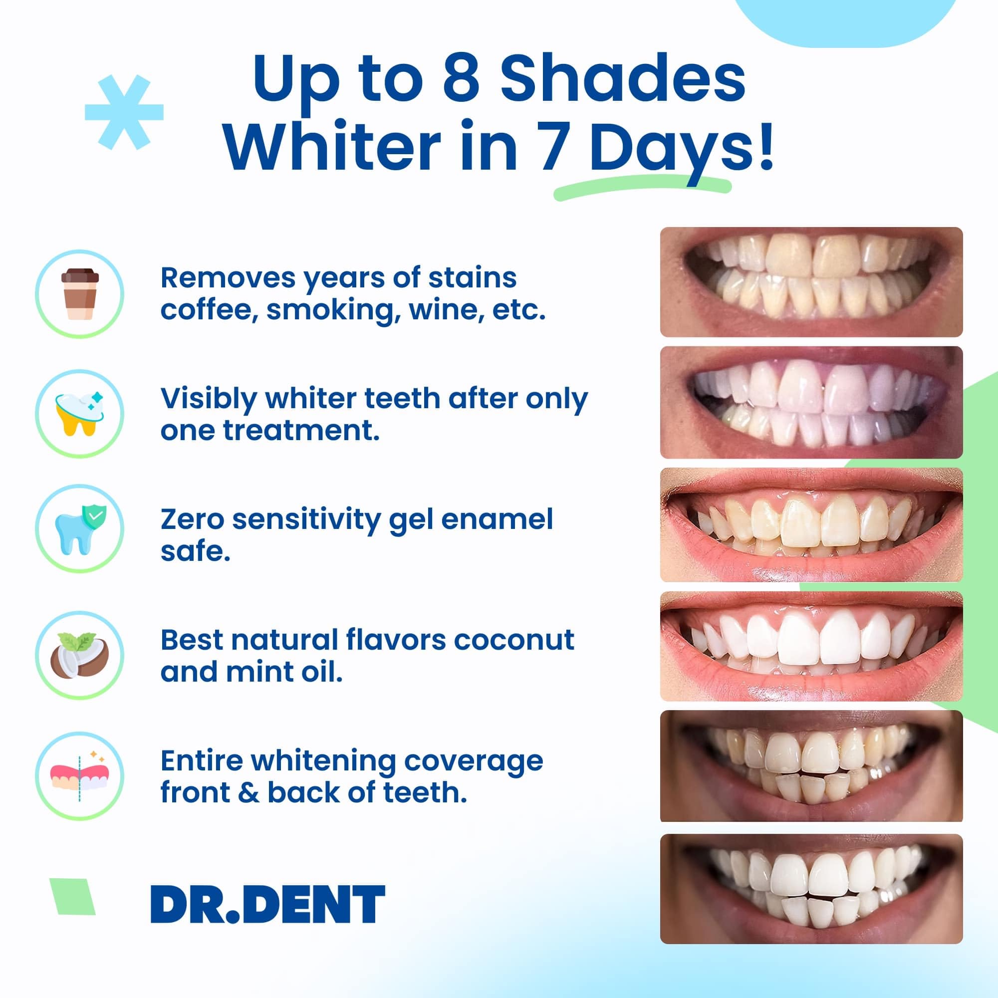 DRDENT Professional Teeth Whitening Strips 21 Treatments - Safe for Enamel - Non Sensitive Teeth Whitening - Whitening Without Any Harm - Pack of 42 Strips and Mouth Opener Included