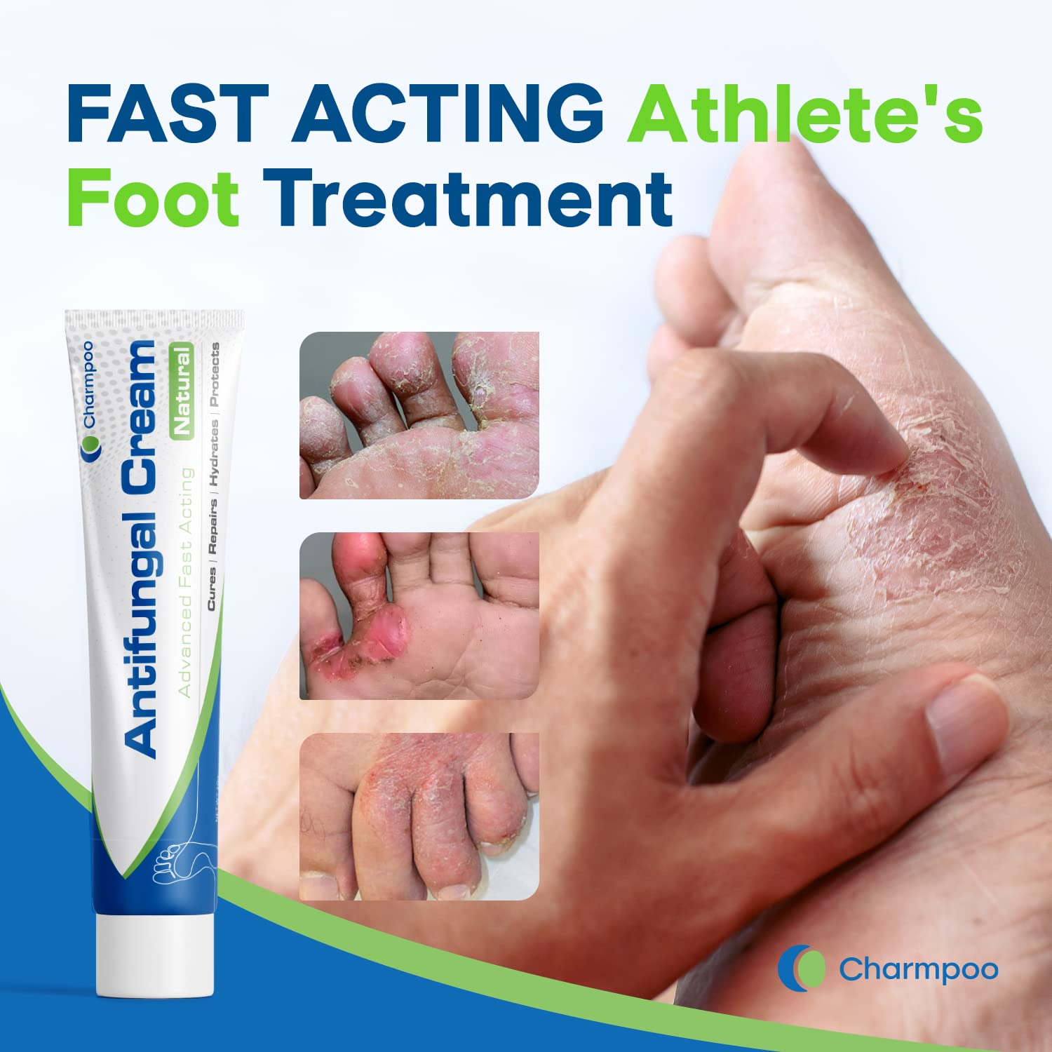 Athletes Foot Treatment, Antifungal Cream, Anti Fungus Skin Cream Extra Strength, Athletes Foot Cream for Men, Ringworm Antifungal Cream, Fast Relief for Jock Inch & Fungal Infections（1pack）