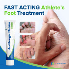 Athletes Foot Treatment, Antifungal Cream, Anti Fungus Skin Cream Extra Strength, Athletes Foot Cream for Men, Ringworm Antifungal Cream, Fast Relief for Jock Inch & Fungal Infections（1pack）