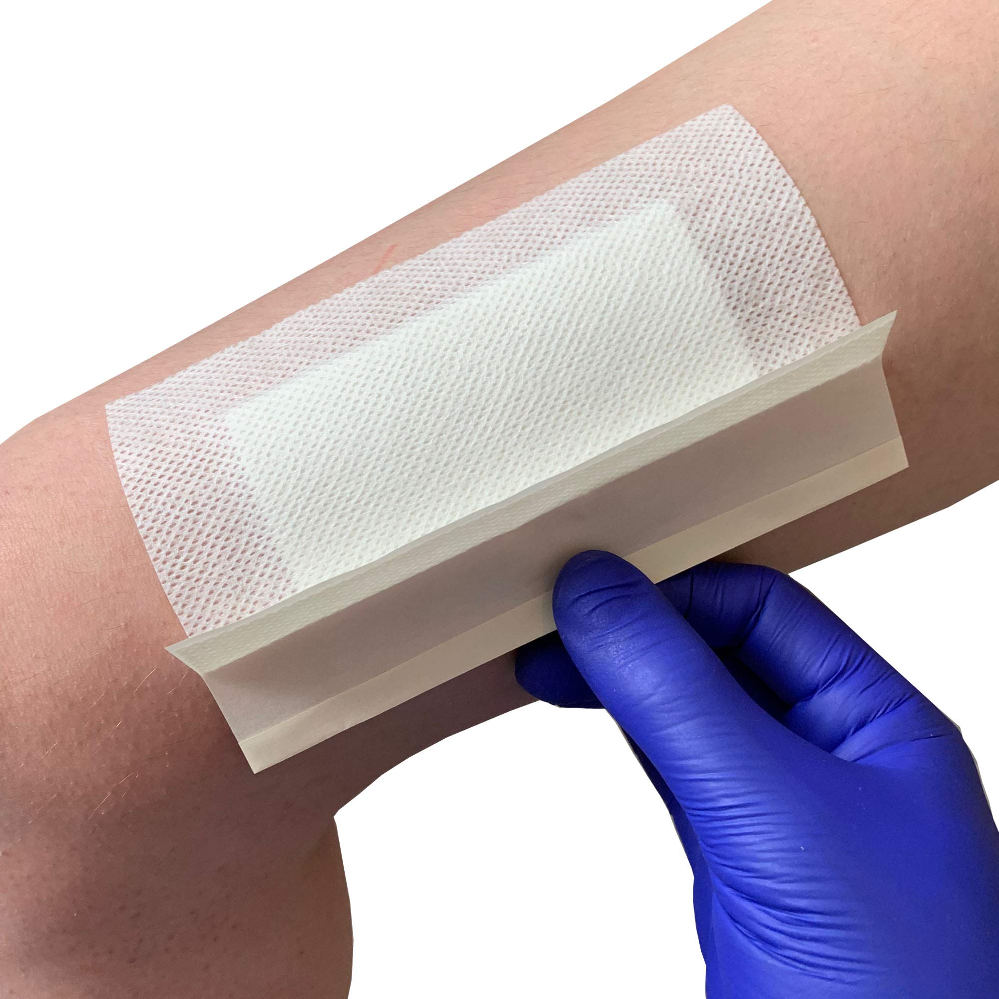 Pack of 10 Cutiderm Adhesive Sterile Wound Dressings - Suitable for cuts and grazes, Diabetic Leg ulcers, venous Leg ulcers, Small Pressure sores (80mm x 150mm)