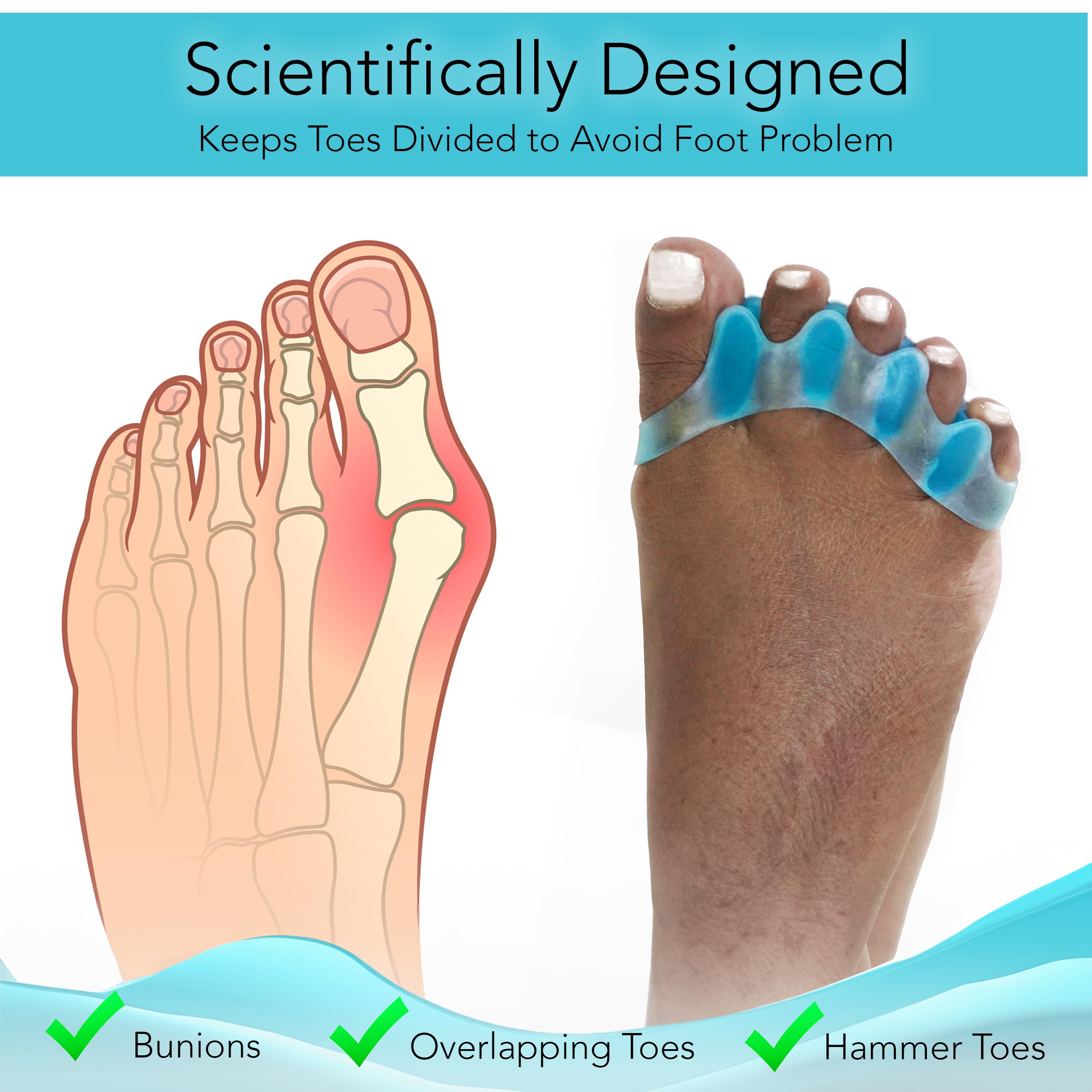 Toe Separators (2 Pairs Blue) - Correct Your Toes with Toe Spacers, Help Relieve Foot Pain, Hammertoe, Bunions by unel