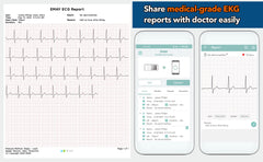 EMAY Bluetooth Portable ECG/EKG Monitor (for iPhone & Android, Mac & Windows)   Wireless Personal ECG Monitor Works with Smartphones   Records Rhythm & Heart Rate, Gives Instant Detections (EMG-20)